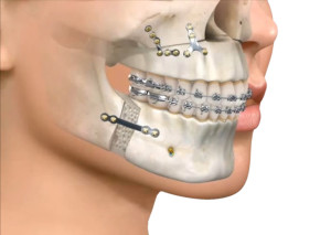 cirugiamaxilofacial1